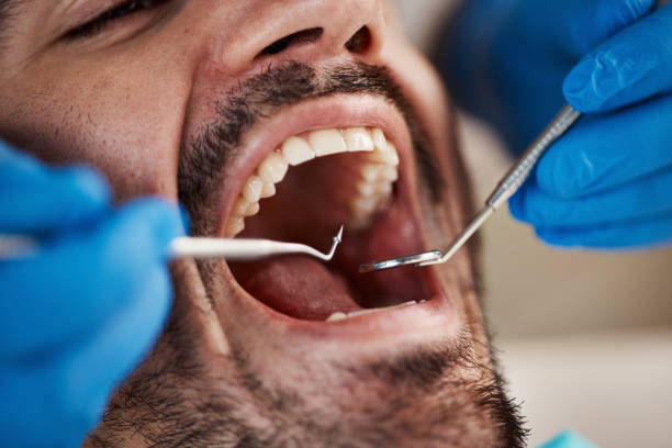 Best Teeth Whitening  in Franklin Farm, VA