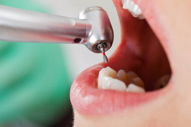 Best Broken Tooth Emergency  in Franklin Farm, VA